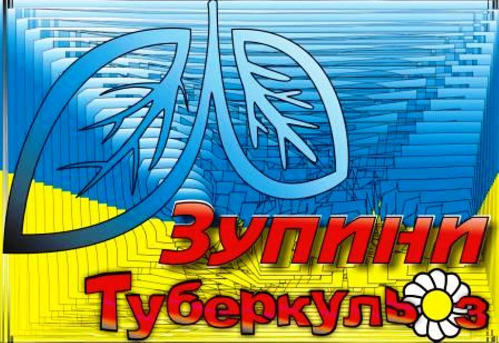 Медики Херсонщини планують ударити по туберкульозу 